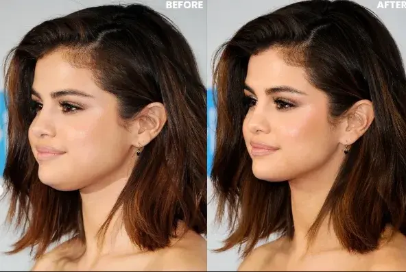 Double Chin Corrector